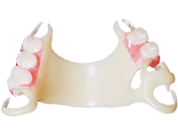 No-metal partial dentures